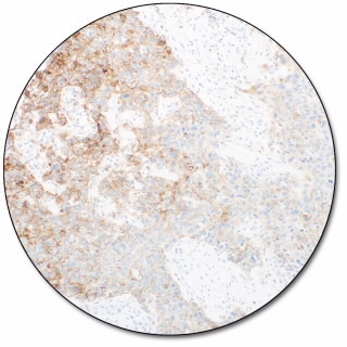 PD-L1 IHC 28-8 pharmDx「ダコ」 (ダコ　Autostainer Link 48 用)